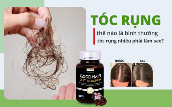 Ngăn ngừa rụng tóc cùng với Innovative Shampoo to prevent Hair Loss